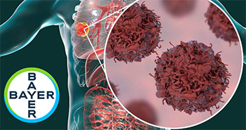 Bayer Logo auf einer Zeichnung einer menschlichen Lunge